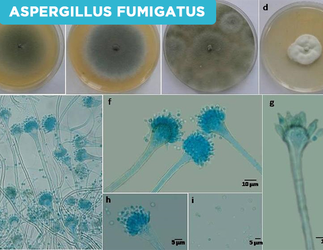 ASPERGILLUS FUMIGATUS