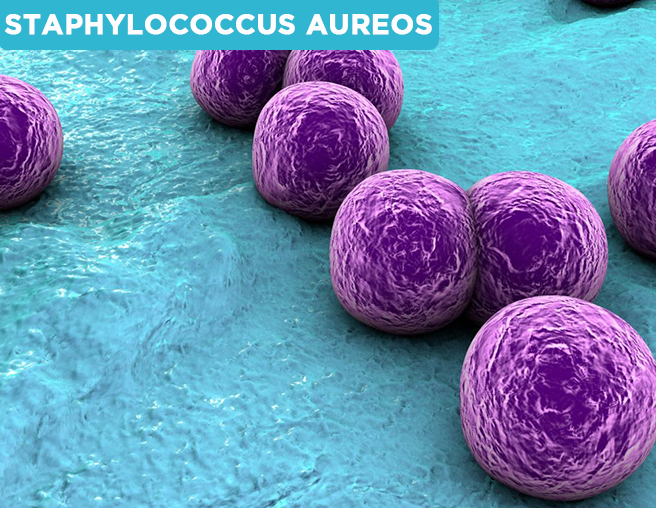 STAPHYLOCOCCUS AUREOS